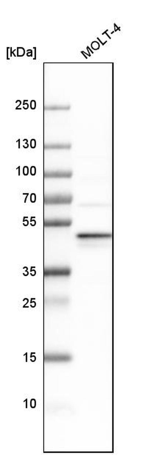 RDBP Antibody in Western Blot (WB)