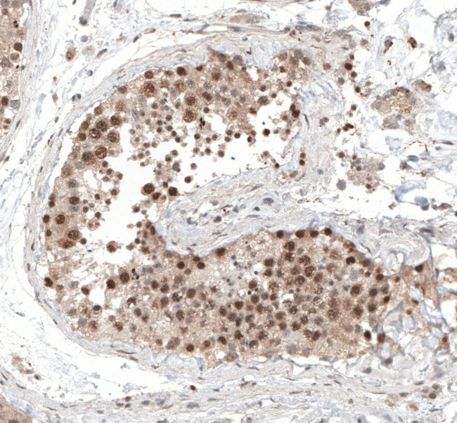 ALKBH5 Antibody in Immunohistochemistry (IHC)