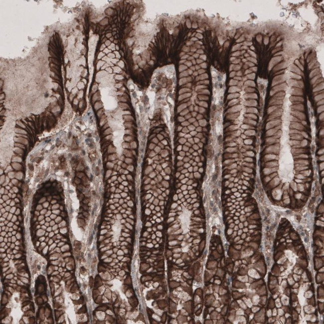 LSR Antibody in Immunohistochemistry (IHC)