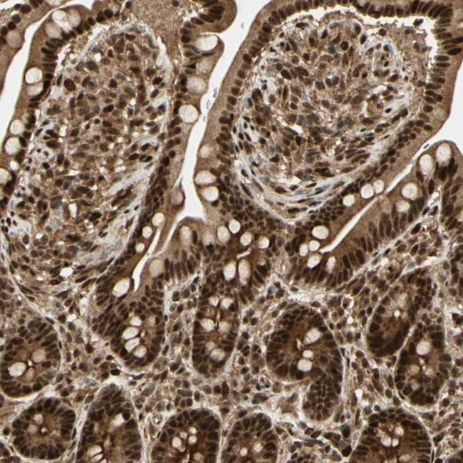 ZSCAN30 Antibody in Immunohistochemistry (IHC)