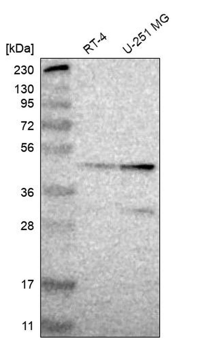 ZSCAN30 Antibody in Western Blot (WB)