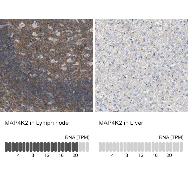 MAP4K2 Antibody in Immunohistochemistry (IHC)