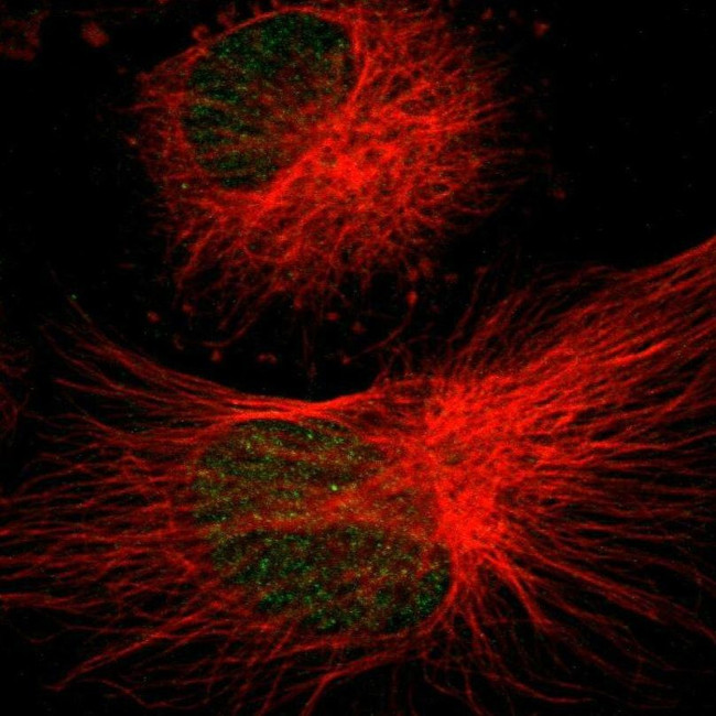 SGCG Antibody in Immunocytochemistry (ICC/IF)