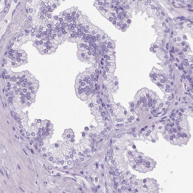 SGCG Antibody in Immunohistochemistry (IHC)