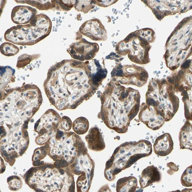 WIPI1 Antibody in Immunohistochemistry (IHC)