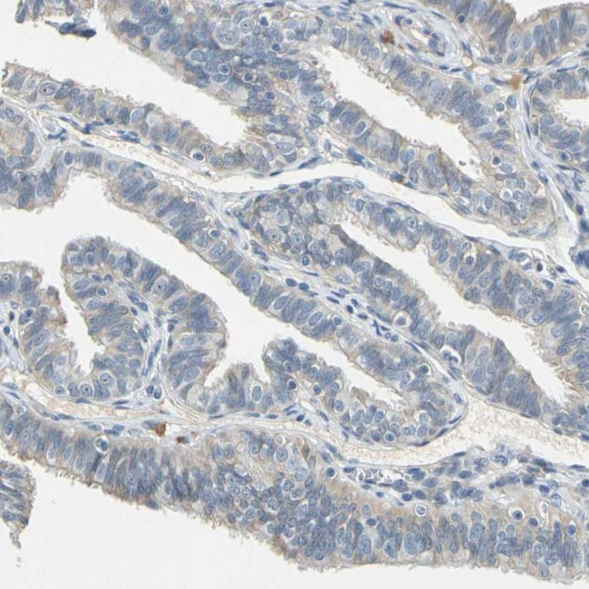 WIPI1 Antibody in Immunohistochemistry (IHC)