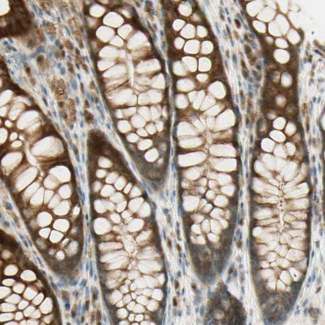 Plexin-A1 Antibody in Immunohistochemistry (IHC)