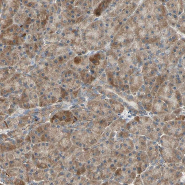 P4HA1 Antibody in Immunohistochemistry (IHC)