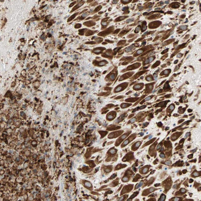 P4HA1 Antibody in Immunohistochemistry (IHC)