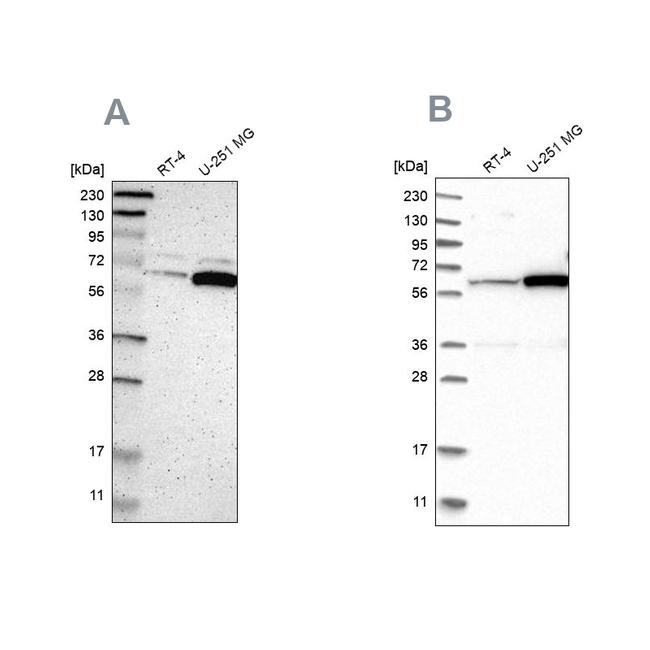 P4HA1 Antibody in Western Blot (WB)