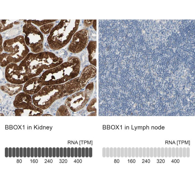 BBOX1 Antibody in Immunohistochemistry (IHC)