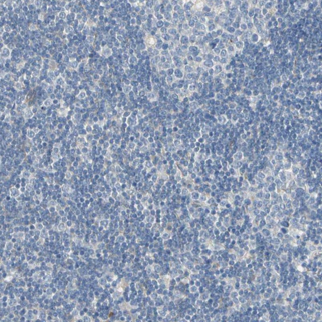 BBOX1 Antibody in Immunohistochemistry (IHC)