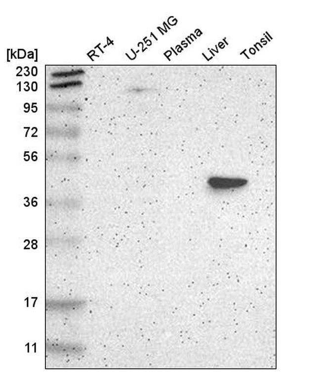 BBOX1 Antibody in Western Blot (WB)