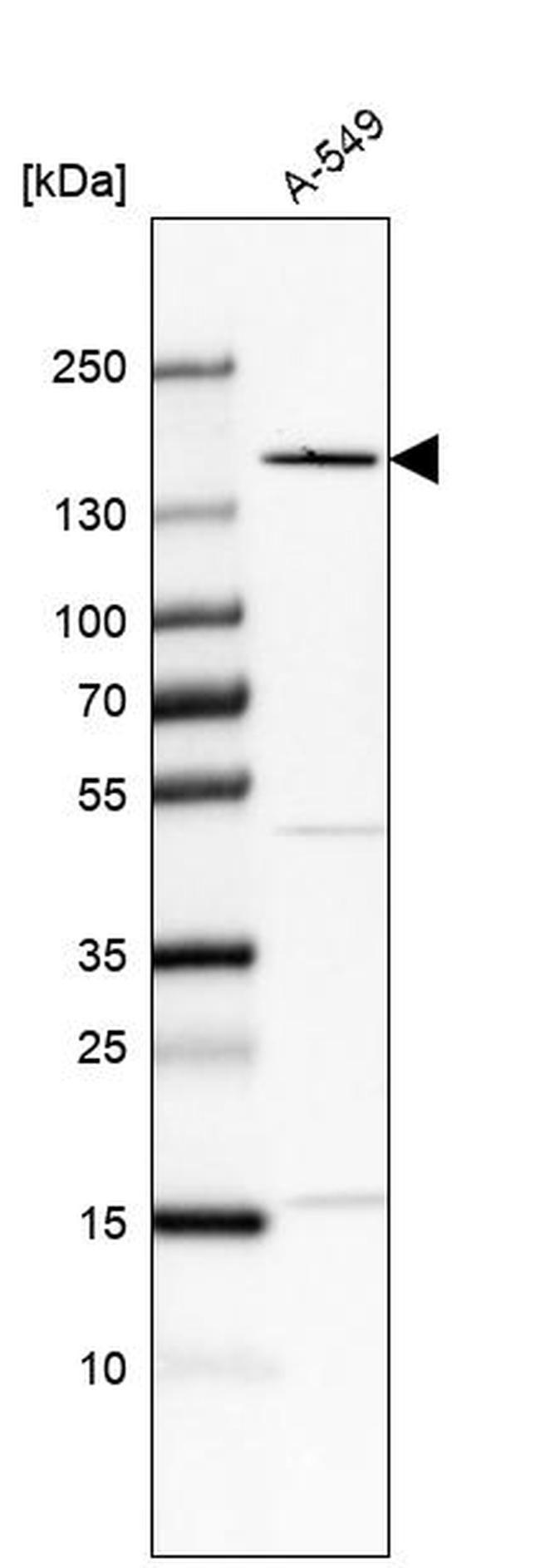 FNDC3B Antibody in Western Blot (WB)