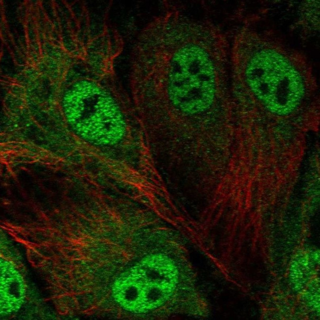 ABCA3 Antibody in Immunocytochemistry (ICC/IF)