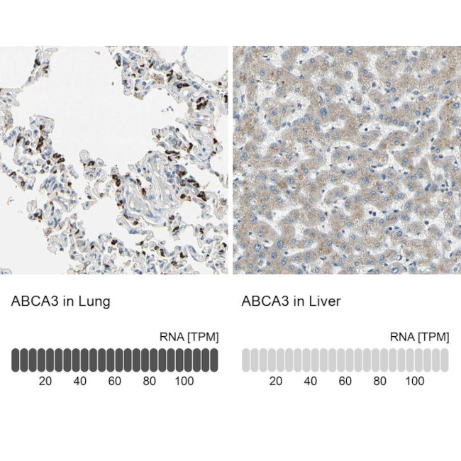 ABCA3 Antibody in Immunohistochemistry (IHC)