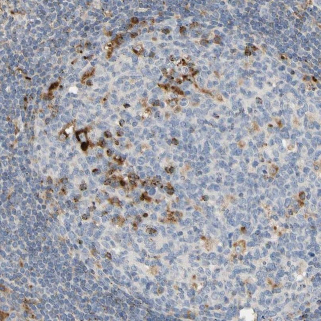 CECR1 Antibody in Immunohistochemistry (IHC)