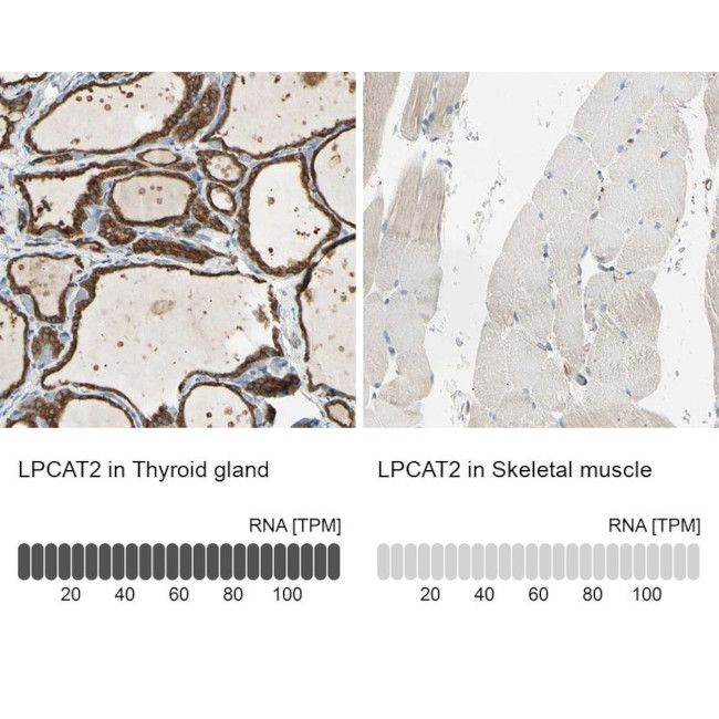 LPCAT2 Antibody in Immunohistochemistry (IHC)