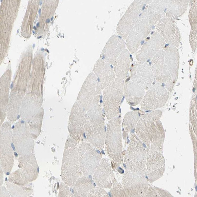 LPCAT2 Antibody in Immunohistochemistry (IHC)