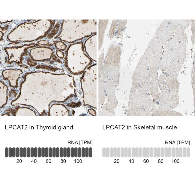 LPCAT2 Antibody