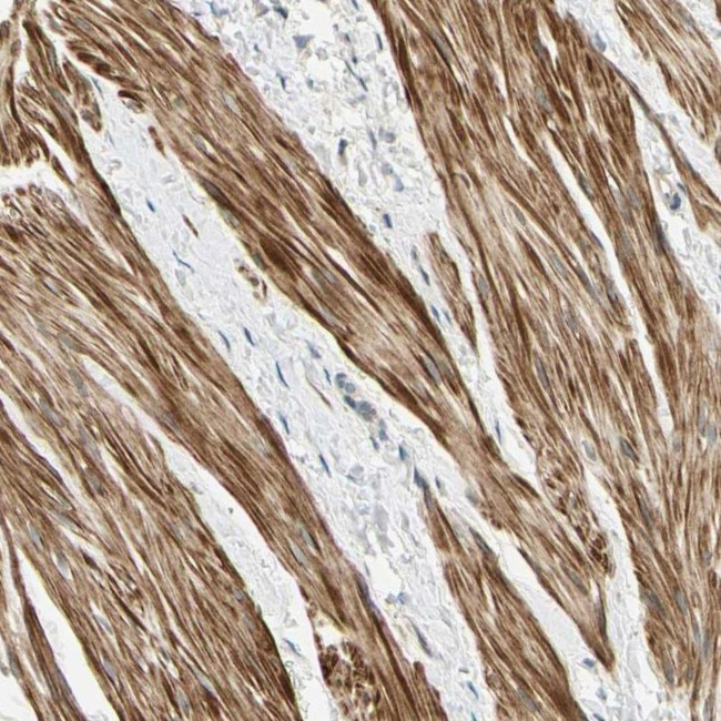 P4HA3 Antibody in Immunohistochemistry (IHC)