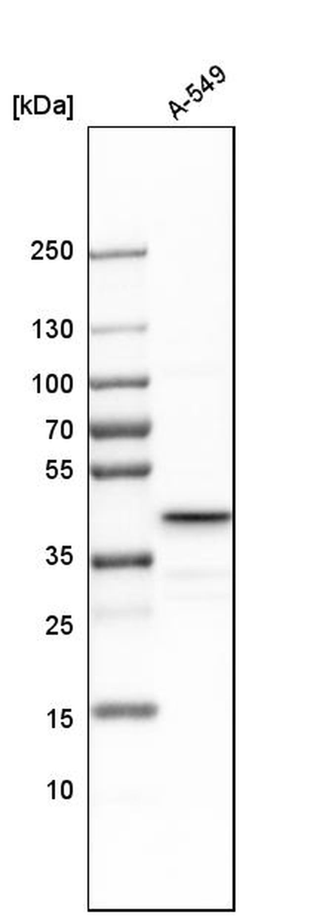 UBE2Z Antibody in Western Blot (WB)