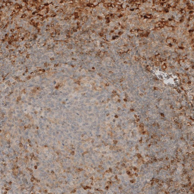 VISTA Antibody in Immunohistochemistry (IHC)