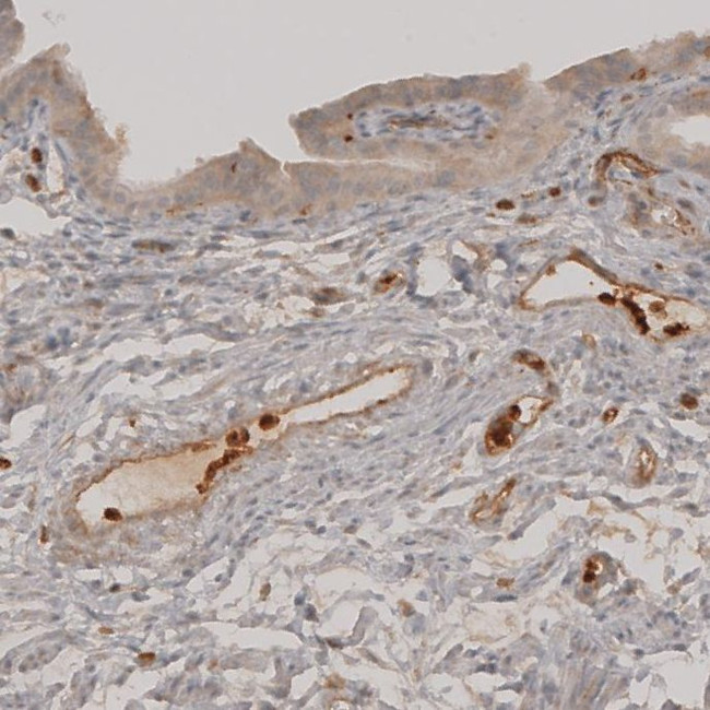 VISTA Antibody in Immunohistochemistry (IHC)