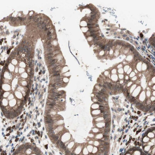 ALG5 Antibody in Immunohistochemistry (IHC)