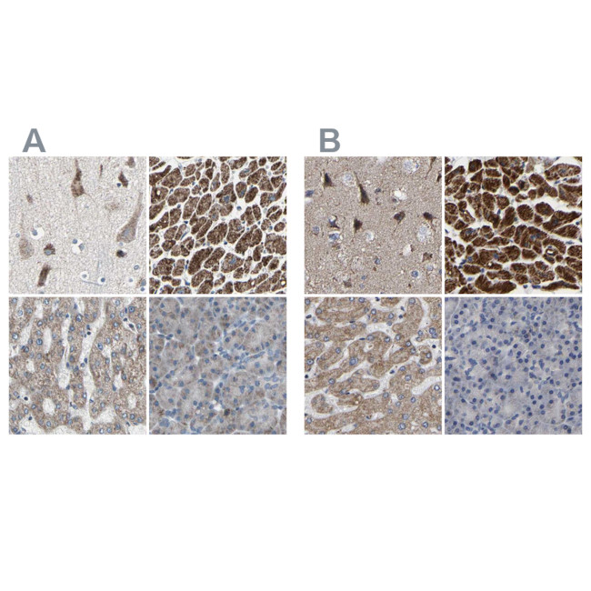 UQCRC2 Antibody in Immunohistochemistry (IHC)