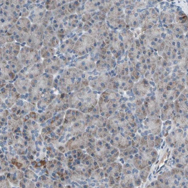 UQCRC2 Antibody in Immunohistochemistry (IHC)