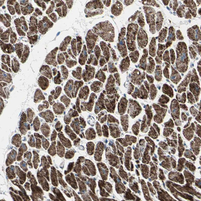 UQCRC2 Antibody in Immunohistochemistry (IHC)