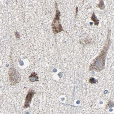 UQCRC2 Antibody in Immunohistochemistry (IHC)