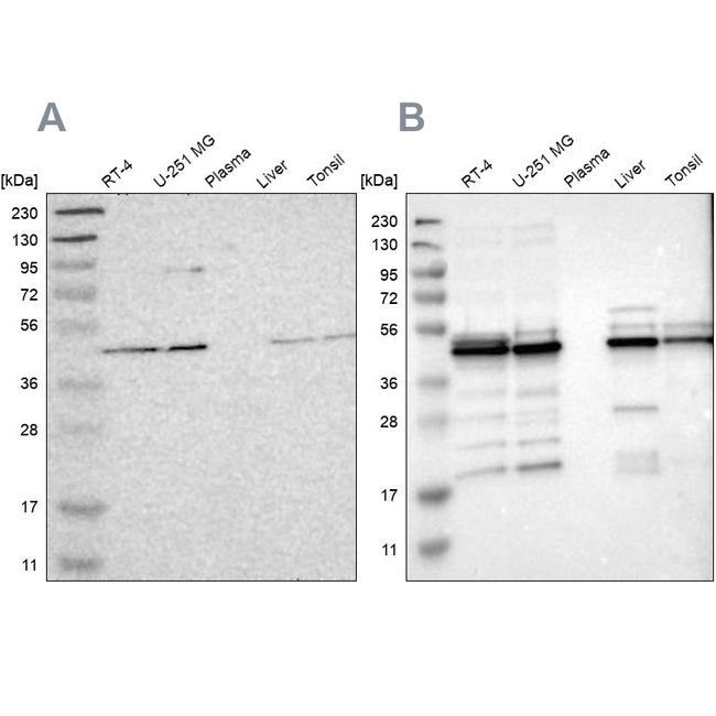 UQCRC2 Antibody in Western Blot (WB)