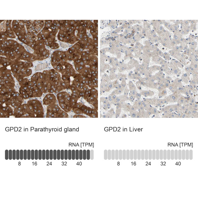 GPD2 Antibody in Immunohistochemistry (IHC)