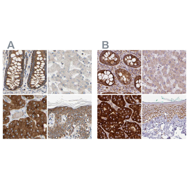 GPD2 Antibody in Immunohistochemistry (IHC)