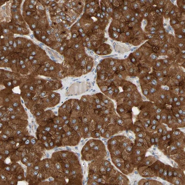 GPD2 Antibody in Immunohistochemistry (IHC)