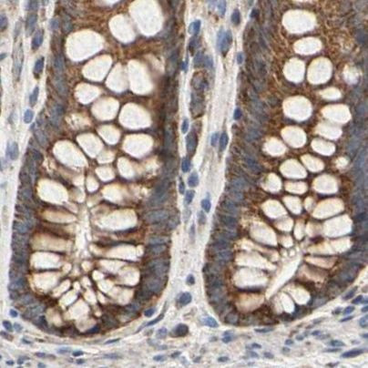 GPD2 Antibody in Immunohistochemistry (IHC)