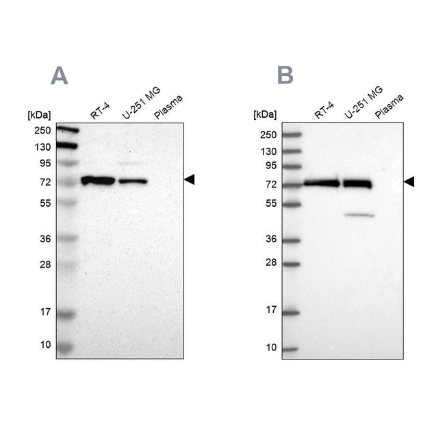 GPD2 Antibody in Western Blot (WB)