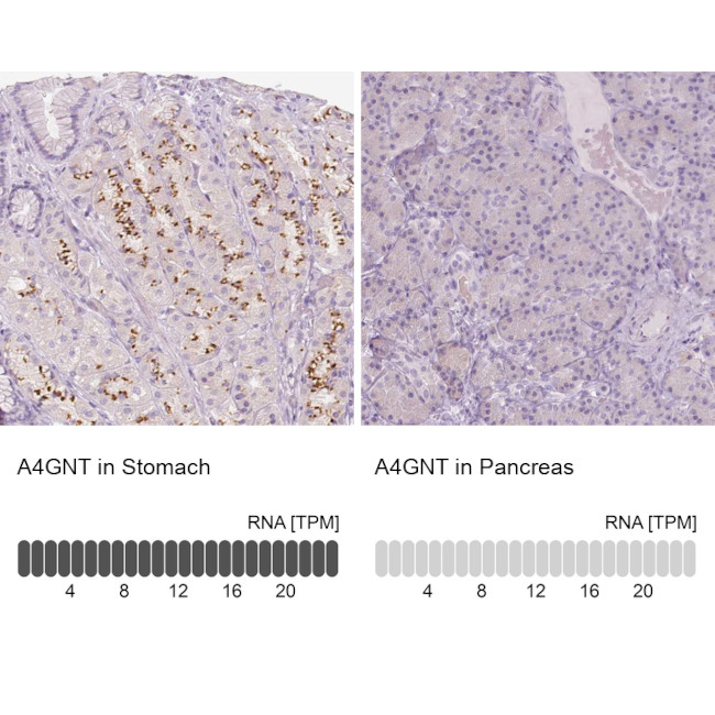 A4GNT Antibody in Immunohistochemistry (IHC)