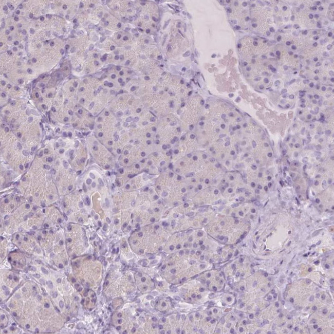 A4GNT Antibody in Immunohistochemistry (IHC)