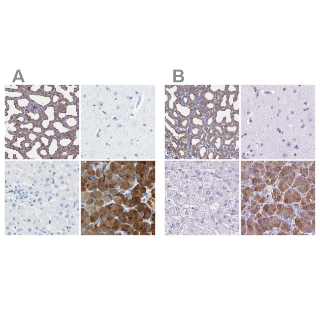 CEL Antibody in Immunohistochemistry (IHC)