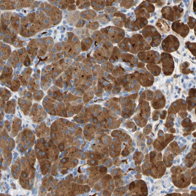 CEL Antibody in Immunohistochemistry (IHC)