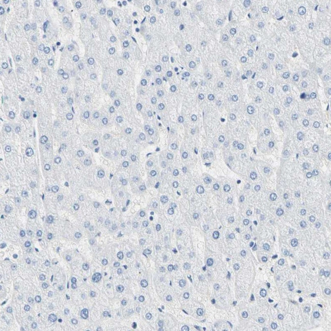 CEL Antibody in Immunohistochemistry (IHC)