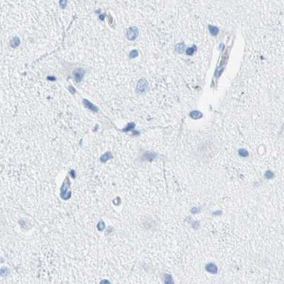 CEL Antibody in Immunohistochemistry (IHC)