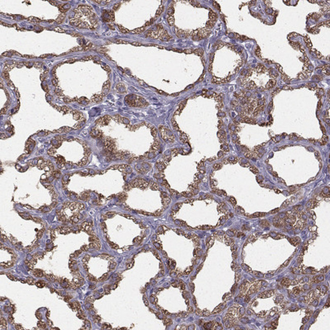 CEL Antibody in Immunohistochemistry (IHC)