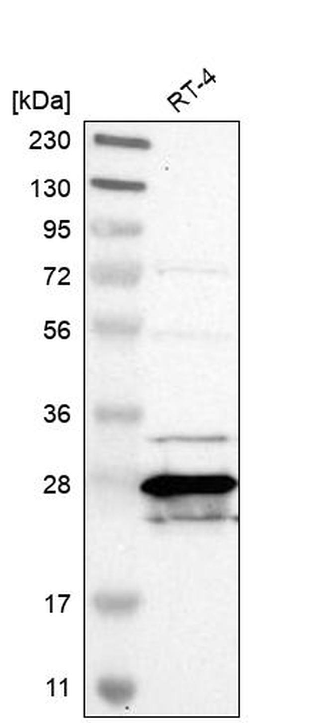 MTHFS Antibody in Western Blot (WB)