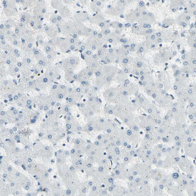 RNF43 Antibody in Immunohistochemistry (IHC)