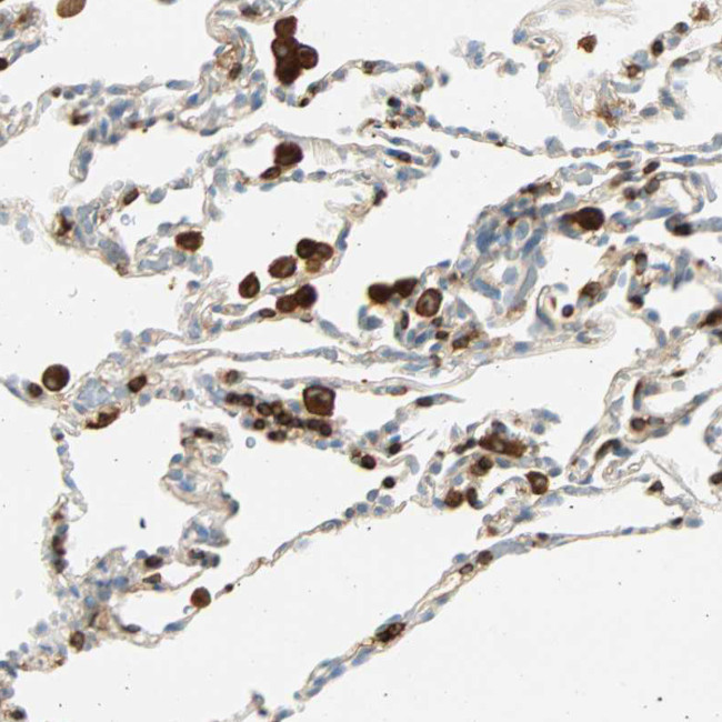 FMNL1 Antibody in Immunohistochemistry (IHC)