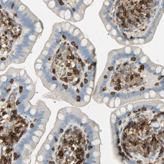 FMNL1 Antibody in Immunohistochemistry (IHC)